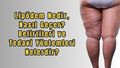 Lipödem Nedir, Nasıl Geçer? Belirtileri ve Tedavi Yöntemleri Nelerdir?