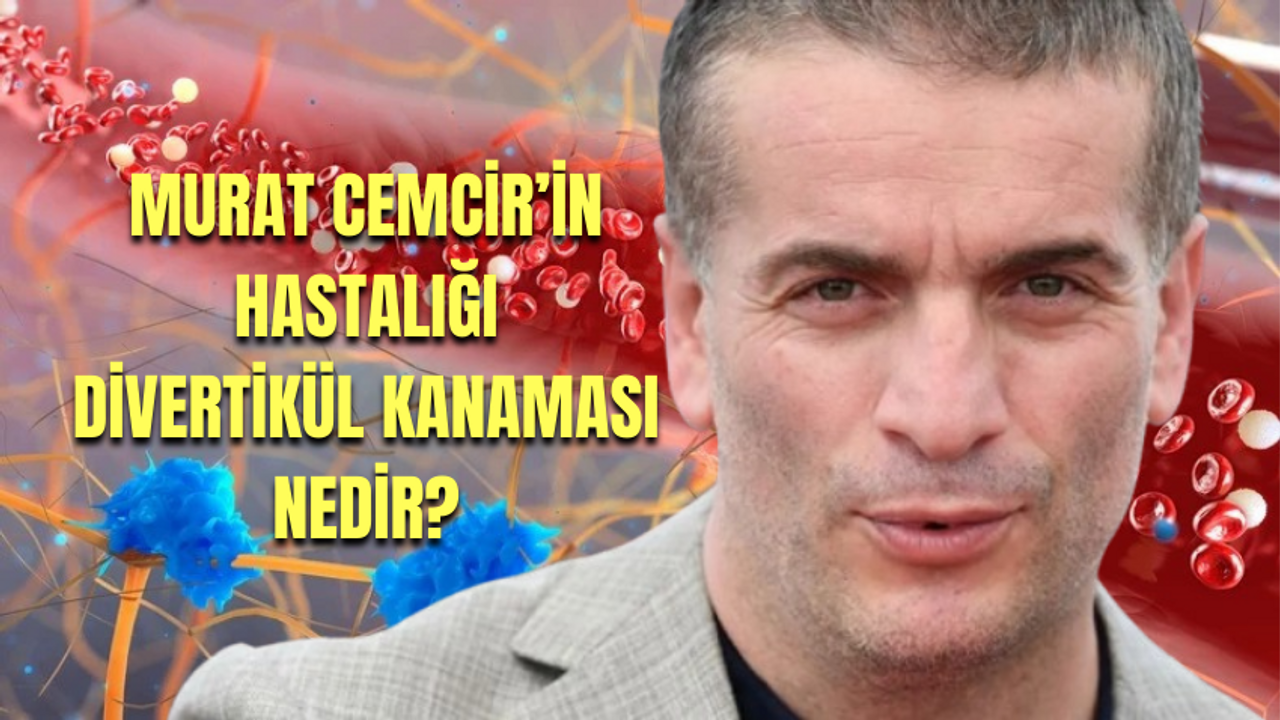 Murat Cemcir'in hastalığı ne? Murat Cemcir'i yoğun bakımlık eden hastalık divertikül kanama nedir?