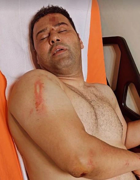 Survivor Hikmet, trafikte dehşet saçtı! Sopayla darp anları kamerada - Resim : 2