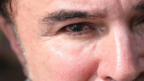 Avukat gözlükten kurtulmak isterken kör oldu! - Resim : 1