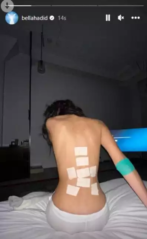 Ünlü model hastalığını bantlarla duyurdu - Resim : 1