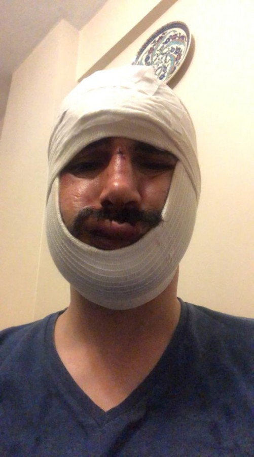 Anadolu Ajansı muhabirine maganda saldırısı! Yüzüne onlarca dikiş atıldı! - Resim : 1