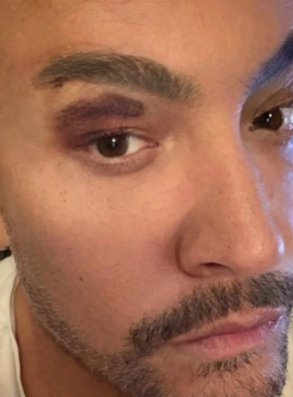 Cenk Eren sahnede can pazarı yaşadı! Mikrofon elinden fırladı - Resim : 1