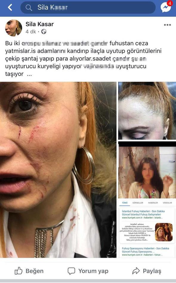 Şarkıcıya kanlı dayak karakolluk oldu! Bıçaklı video, çıplak fotoğraflı montajlar! - Resim : 6