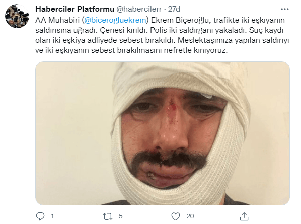 Anadolu Ajansı muhabirine maganda saldırısı! Yüzüne onlarca dikiş atıldı! - Resim : 2