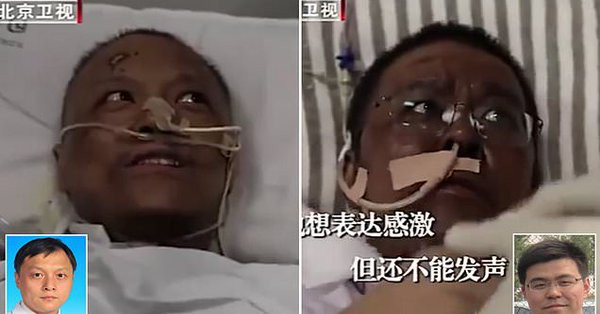 Koronavirüs bulaşan doktorların ten rengi değişti - Resim : 1