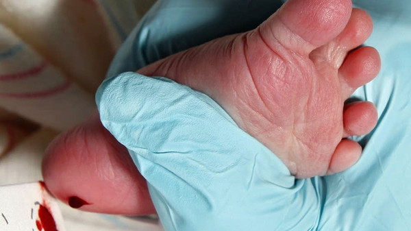 TOPUK KANI NEDEN ALINIR? Topuk kanı nedir, kaç kez, ne zaman alınır? Topuk kanında nelere bakılır?