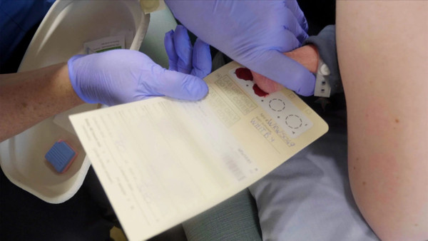 TOPUK KANI NEDEN ALINIR? Topuk kanı nedir, kaç kez, ne zaman alınır? Topuk kanında nelere bakılır?