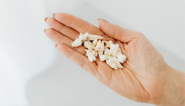 Rüyada dişinin düştüğünü görmek ne anlama gelir? Rüyada azı, köpek, çürük ve alt diş düşmesi anlamı