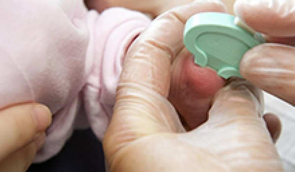 Topuk Kanı Neden 2. Kez Alınır?