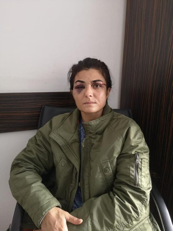 İşkenceci eşini öldürmüştü! Melek İpek hakkında flaş karar - Resim : 1