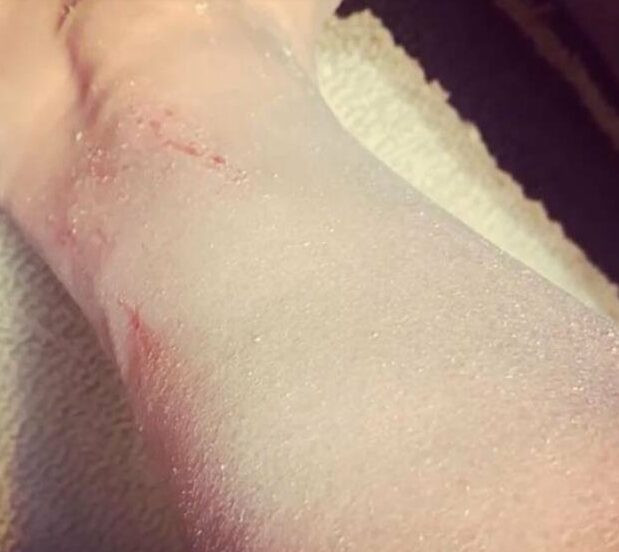 Esra Dermancıoğlu sevenlerini korkuttu! Hastalığını açıkladı! - Resim : 1