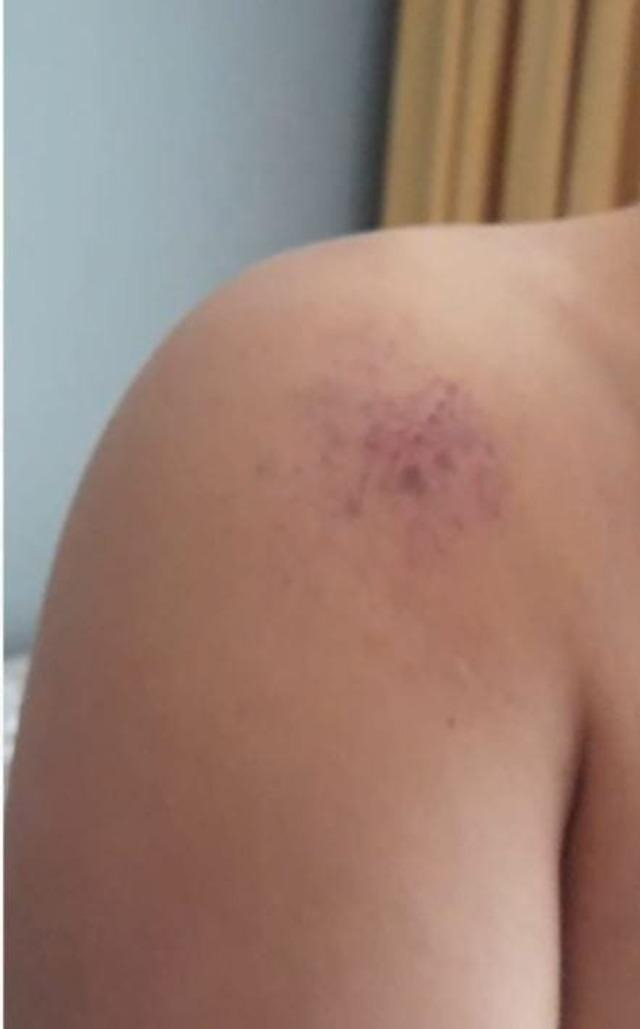 Down sendromlu öğrenciyi darbederek yerlerde sürüklemişti... O öğretmen hakkında karar verildi! - Resim : 1