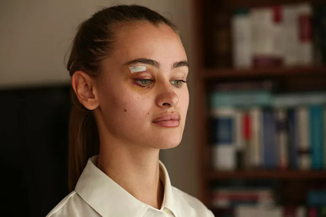 Ünlü model darp iddialarıyla ilgili ilk kez konuştu - Resim : 1