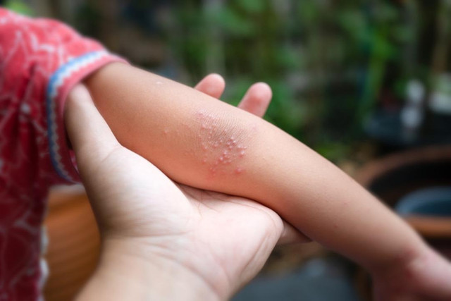 İşte belirtileri masum, kendi ölümcül o hastalık! Gençler risk altında... - Resim : 4