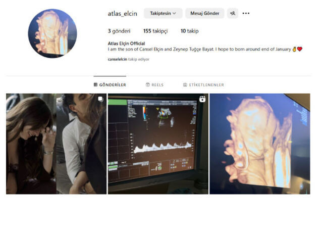 Cansel Elçin ile Zeynep Tuğçe Bayat çifti, oğullarını kucağına aldı - Resim : 3