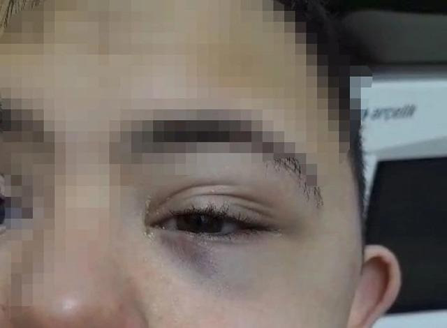 Down sendromlu öğrenciyi darbederek yerlerde sürüklemişti... O öğretmen hakkında karar verildi! - Resim : 2