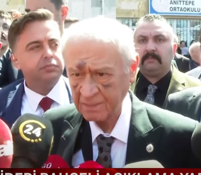 Devlet Bahçeli oy kullandı: Yüzündeki morluklar dikkat çekti! - Resim : 1