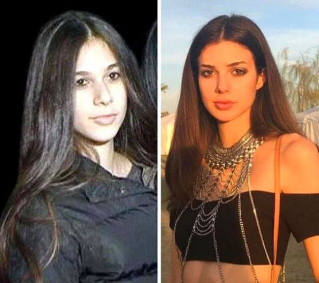 Deren Talu'nun estetiksiz hali şaşırttı! - Resim : 1