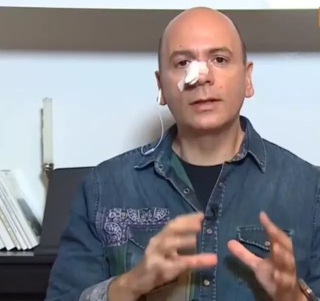 Burnu kanadı, Atv ana haber'i sunamadı! Ünlü haber spikeri son durumunu anlattı - Resim : 2