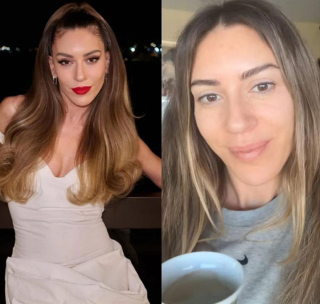 Elle gecesinde son hali gündem oldu! Sinem Kobal'dan makyajsız paylaşım - Resim : 3