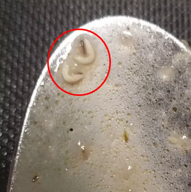 Denizli'deki KYK yurdu ile ilgili skandal iddia! Yemeklerden çıkanlar mide bulandırdı! - Resim : 1