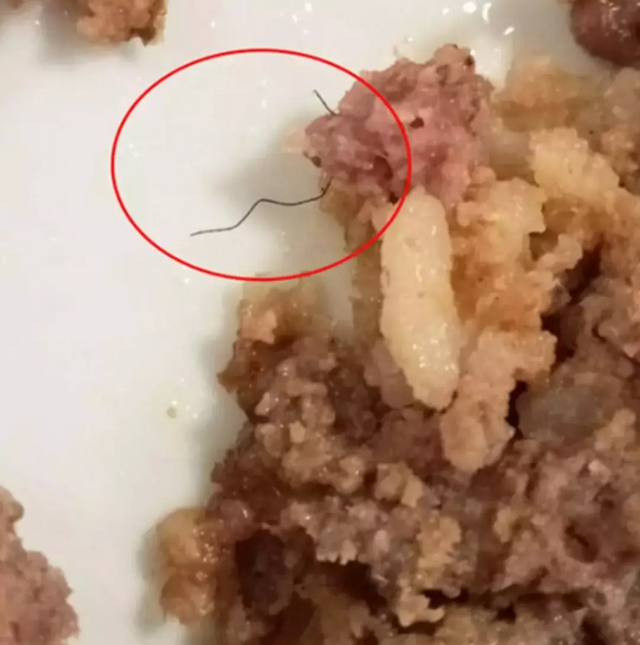 Denizli'deki KYK yurdu ile ilgili skandal iddia! Yemeklerden çıkanlar mide bulandırdı! - Resim : 4