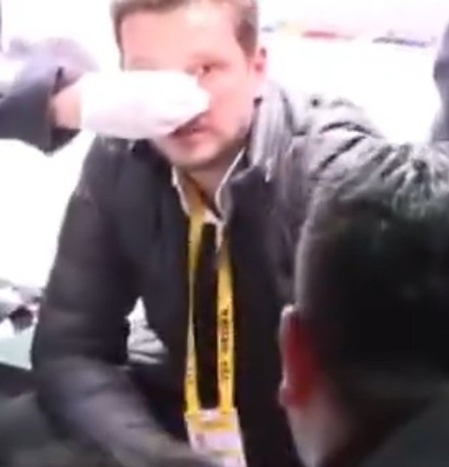 Hasan Arat'ın şoförü, Galatasaraylı muhabirin burnunu kırdı - Resim : 1