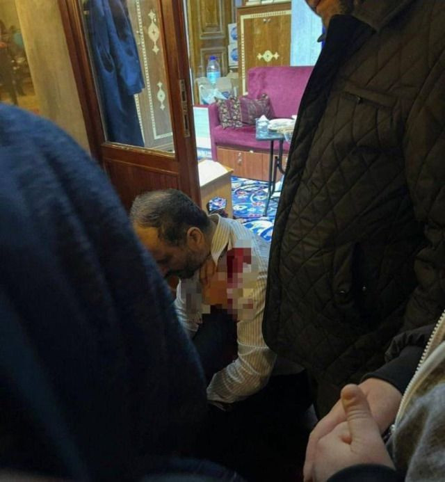 Fatih Camii'ndeki saldırının kan donduran detayları! İmamı, boğazı dahil 3 yerinden bı&ccedil;aklamış - Resim : 2