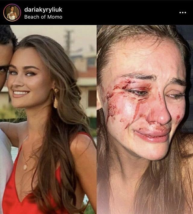 Ünlü model darp iddialarıyla ilgili ilk kez konuştu - Resim : 3