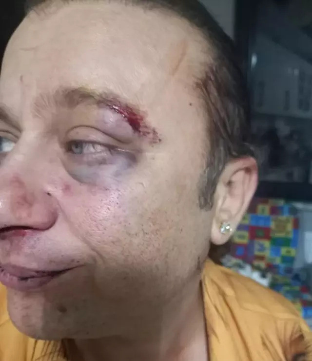 Onur Akay 'mason' demişti, saldırıya uğradı! "Kadir Doğulu için, tarikat için" - Resim : 1