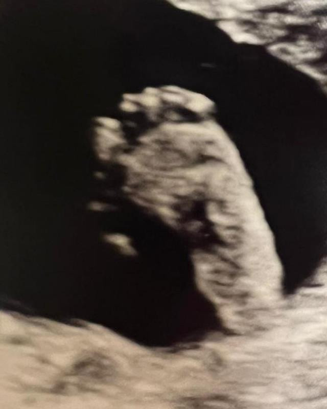 Ünlü oyuncu baba oluyor! Fenomen eşi müjdeyi böyle duyurdu - Resim : 2