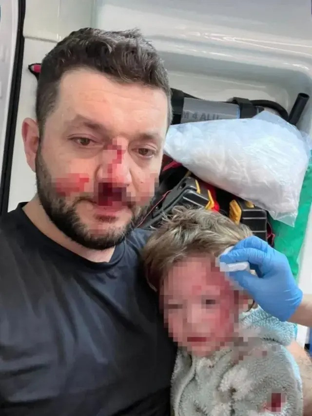 Türkiye'nin konuştuğu Yalova'daki saldırının görüntüleri: 14 aylık bebeğin kafatasını çatlattılar - Resim : 1