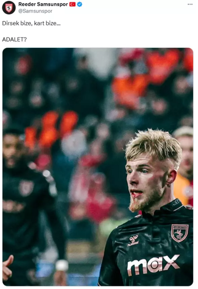 Samsunspor'dan Galatasaray karşılaşması sonrası sert paylaşım! "Dirsek bize, kart bize... Adalet?" - Resim : 1