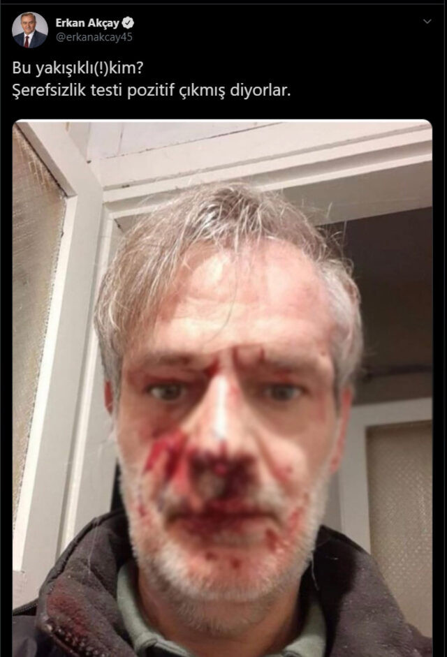 Yeniçağ eski yazarına korona dayağı! MHP'li vekil fotoğrafını paylaştı! - Resim : 1