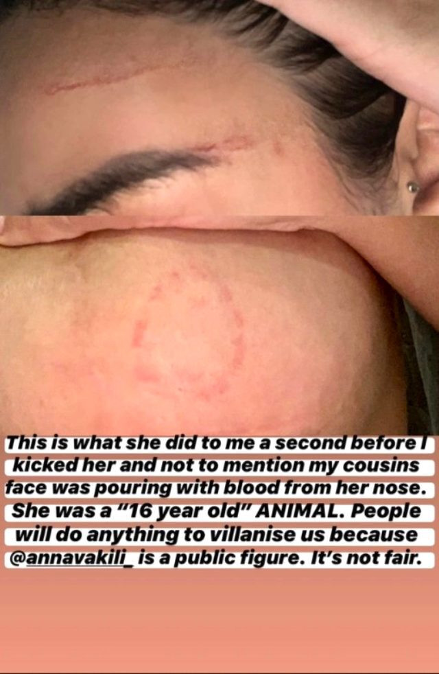 Aşk Adası'nın yıldızı saç saça kavga etti - Resim : 3