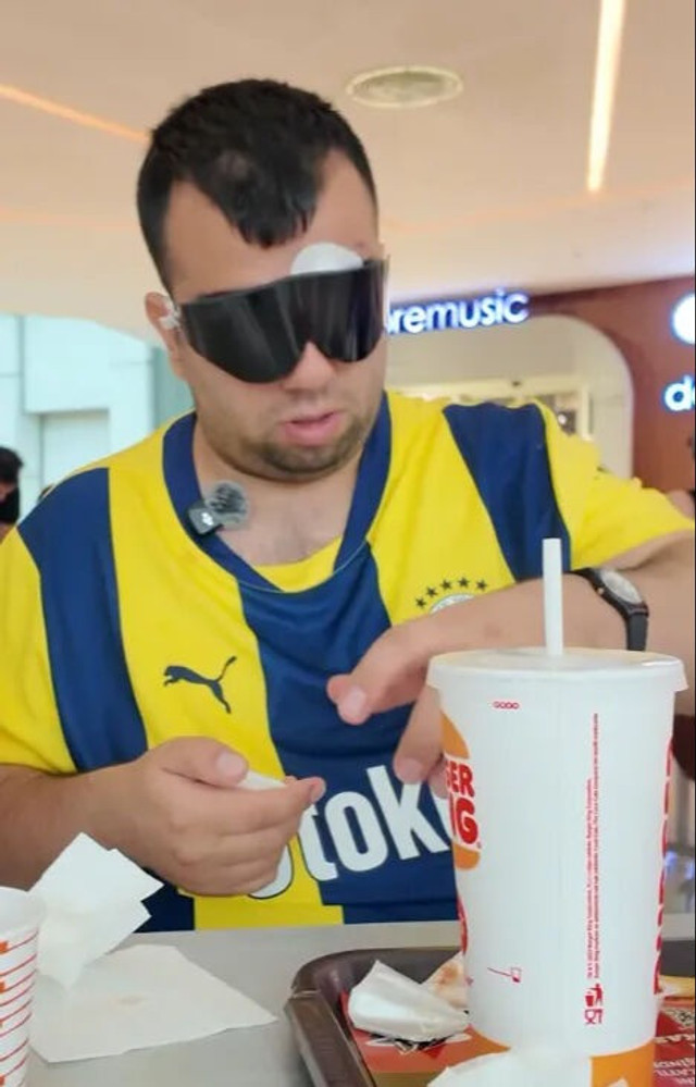 'Kadıköy Boğası'nın ameliyat sonrası ilk görüntüsü ortaya çıktı - Resim : 1