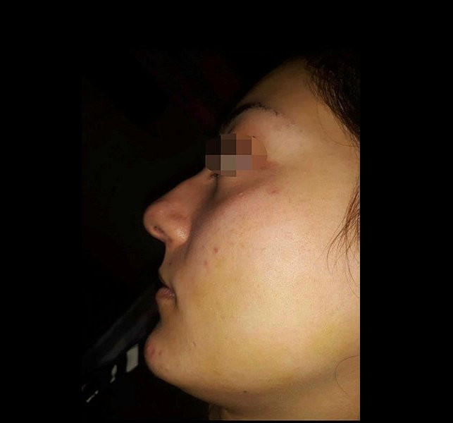 Severek evlendi, 2 ayda cehennemi yaşadı… - Resim : 1