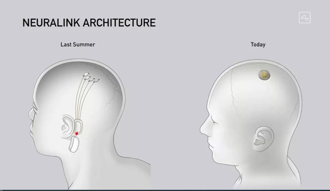 Elon Musk Neuralink çipini tanıttı! İnsan beynine takılacak - Resim : 1