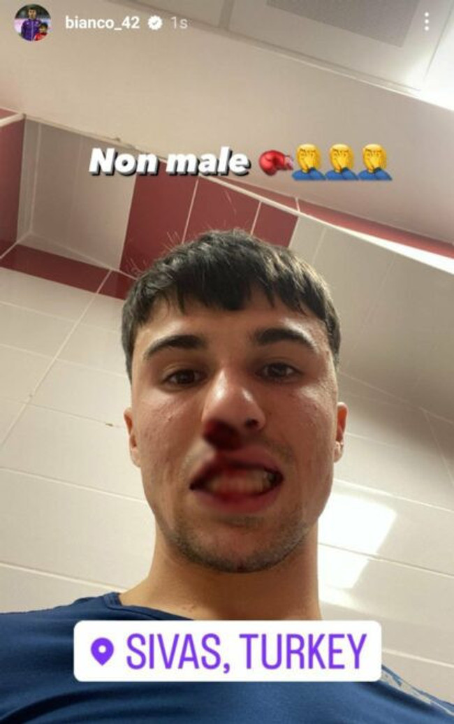 Sivas'ta skandal gece! Sahaya atlayıp burnunu kırdı - Resim : 2