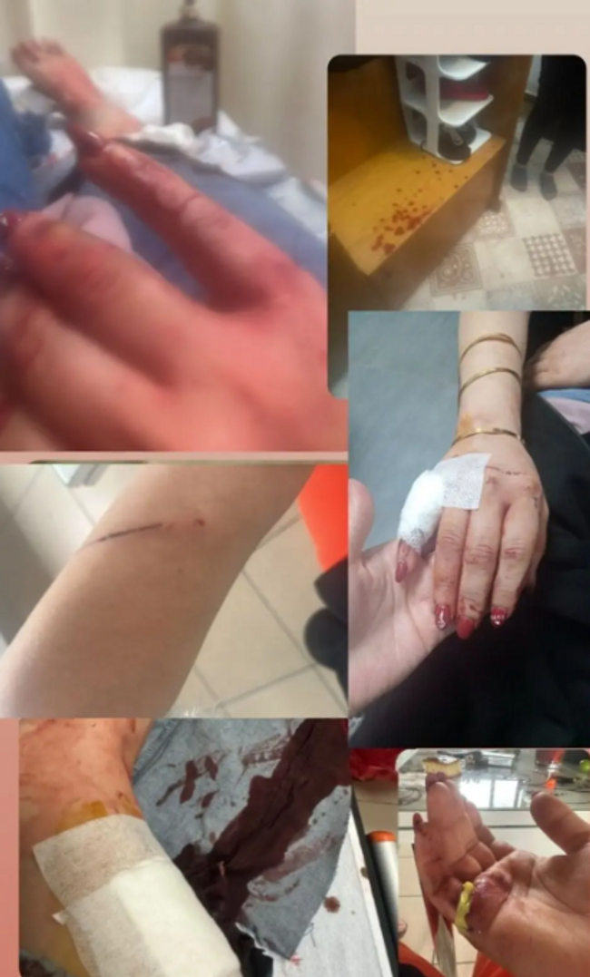 Eski kocası tarafından 6 yerinden bıçaklandı! Kan donduran olay - Resim : 1