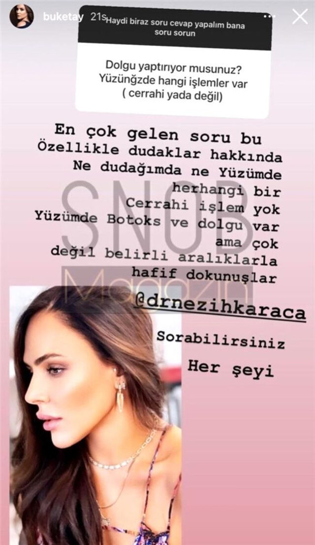 Buket Aydın estetik sorularına eski haliyle yanıt verdi! Yüzündeki değişimler dikkat çekmişti... - Resim : 2