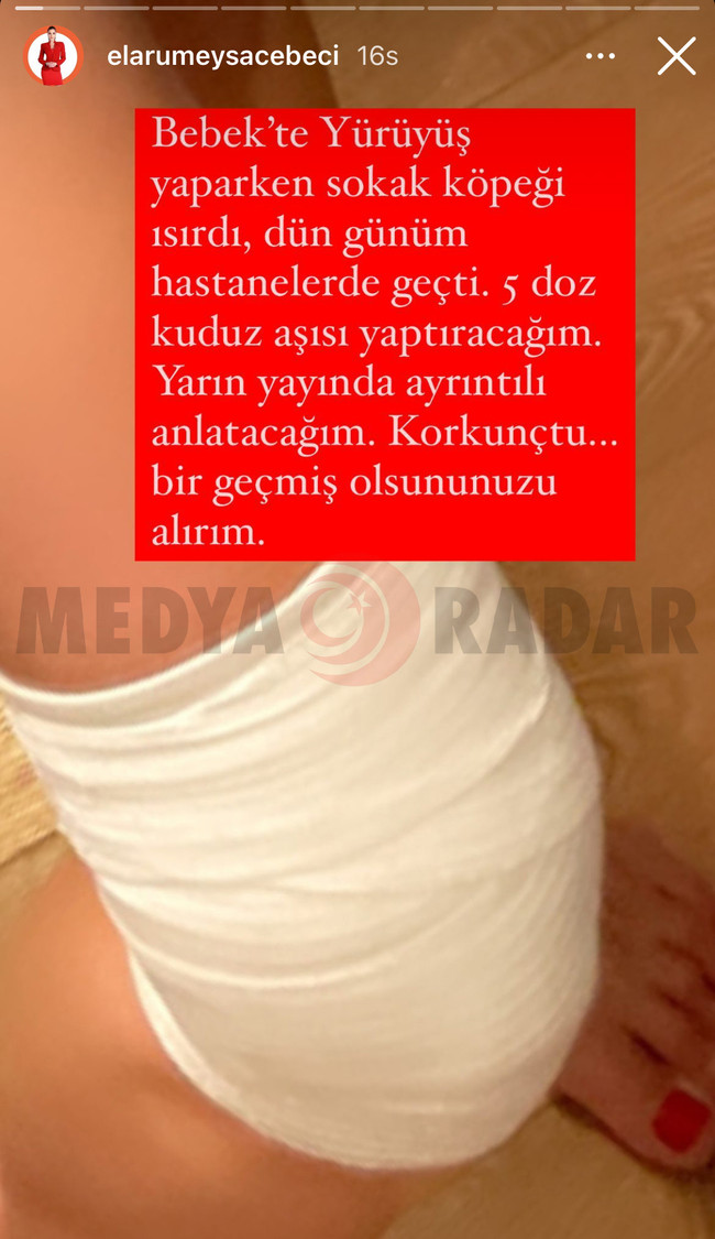 Ünlü sunucu sokakta köpek saldırısına uğradı! ‘Günüm hastanelerde geçti...’ - Resim : 2