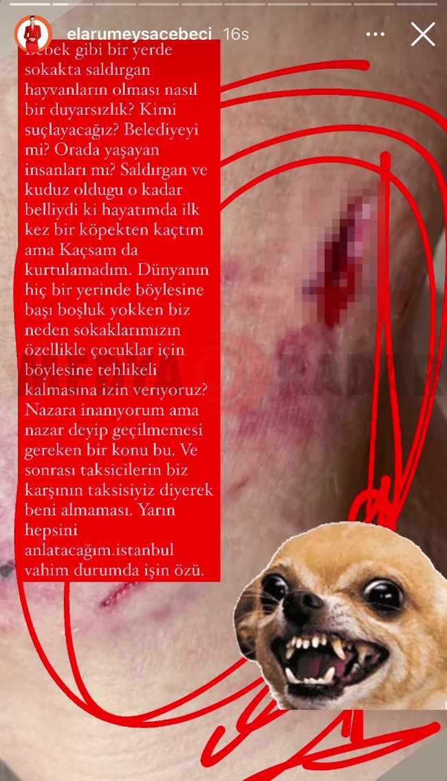 Ünlü sunucu sokakta köpek saldırısına uğradı! ‘Günüm hastanelerde geçti...’ - Resim : 4