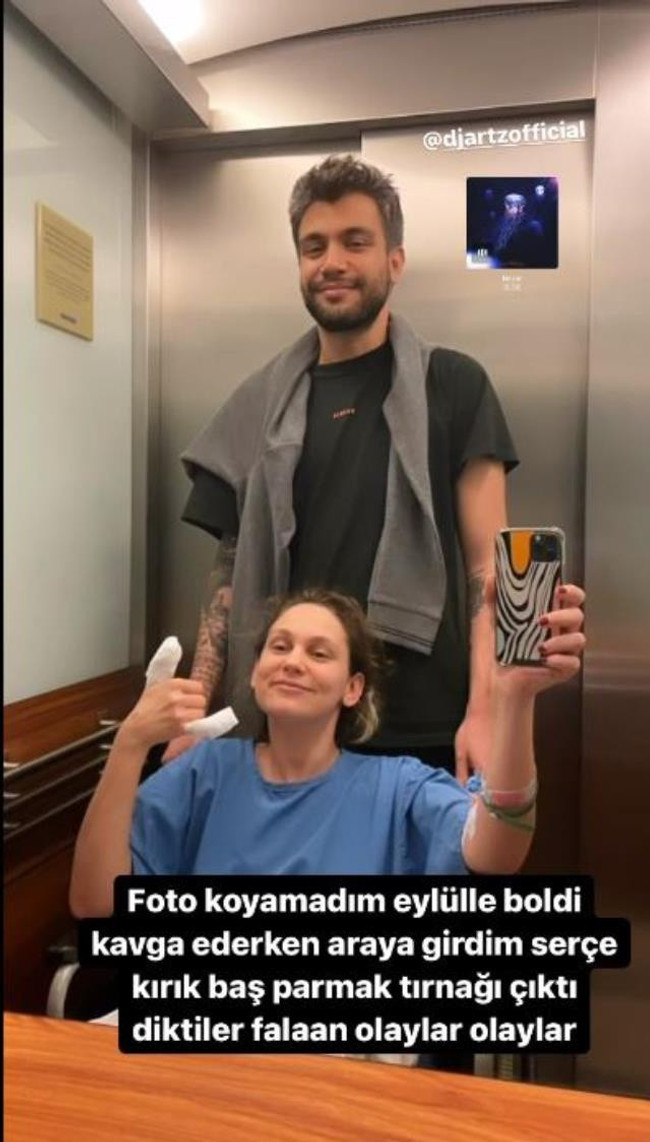 Köpek kavgasının arasında kalan Farah Zeynep Abdullah hastanelik oldu! - Resim : 1