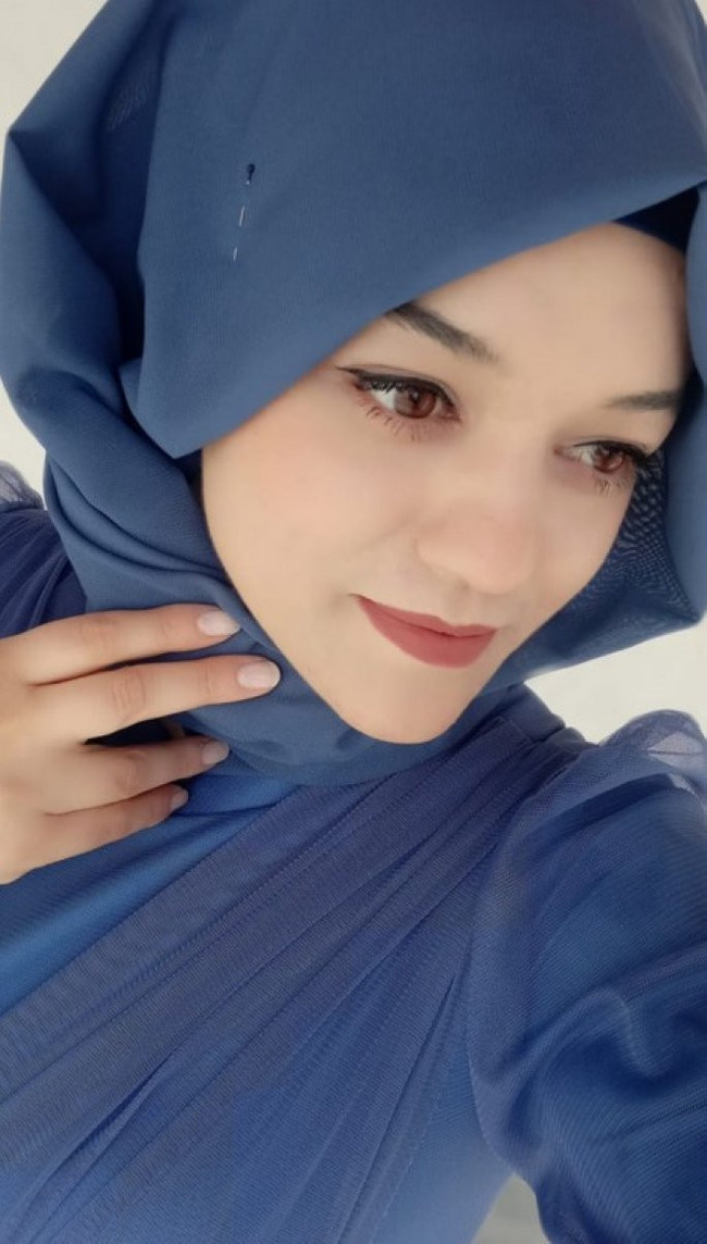 Eski nişanlısının yüzüne kimyasal madde atıp kaçtı - Resim : 2