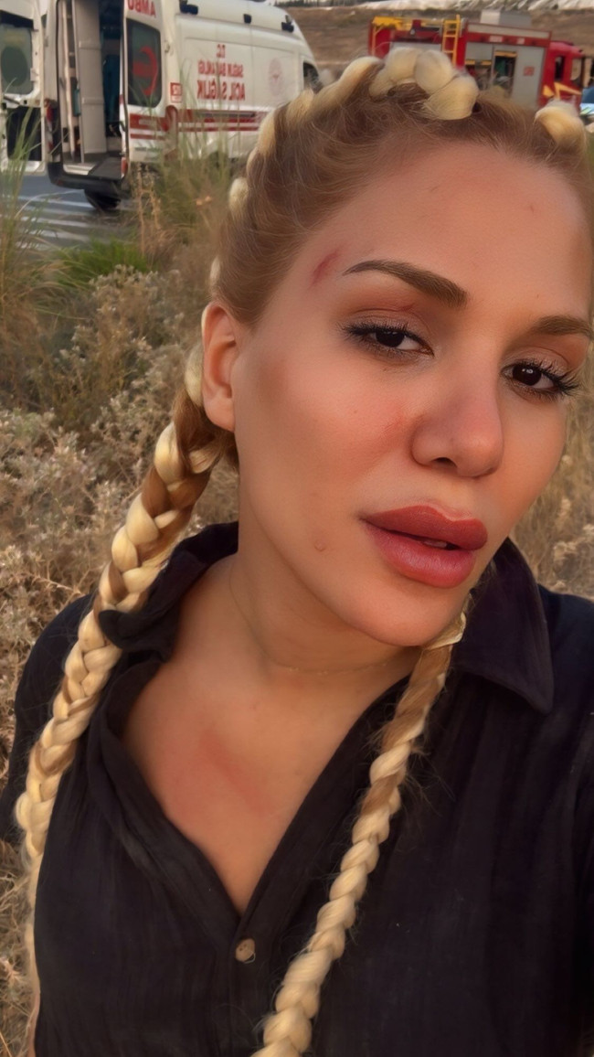Survivor Almeda Baylan’ın aracı takla attı! - Resim : 1
