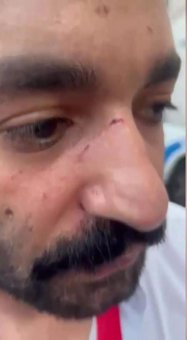 Yine skandal, yine Fernandes! Gazeteciye yumruk atıp koşarak kaçtı... - Resim : 2