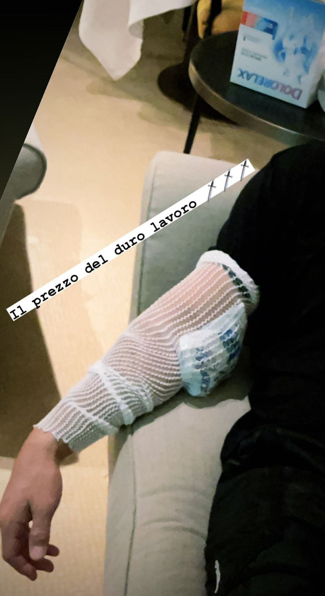 Can Yaman sette kaza geçirdi! - Resim : 1