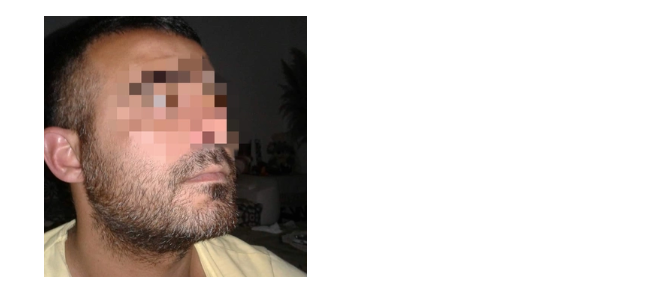 AK Parti binasına taşlı saldırı! Şüpheli yakalandı - Resim : 1